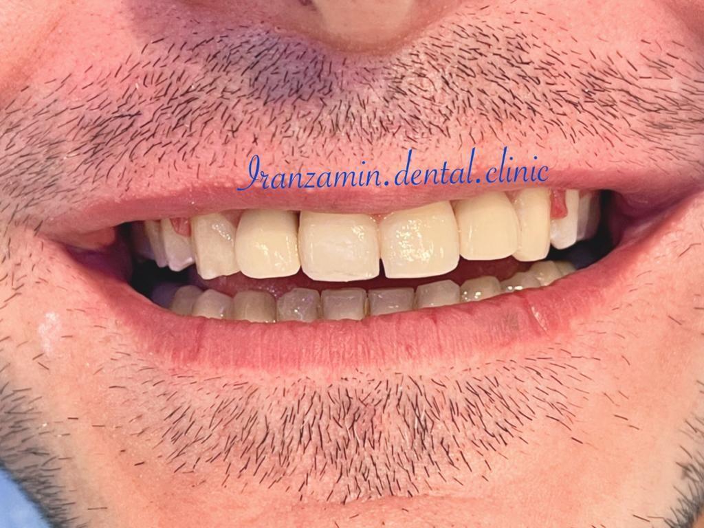 کلینیک دندانپزشکی ایران زمین