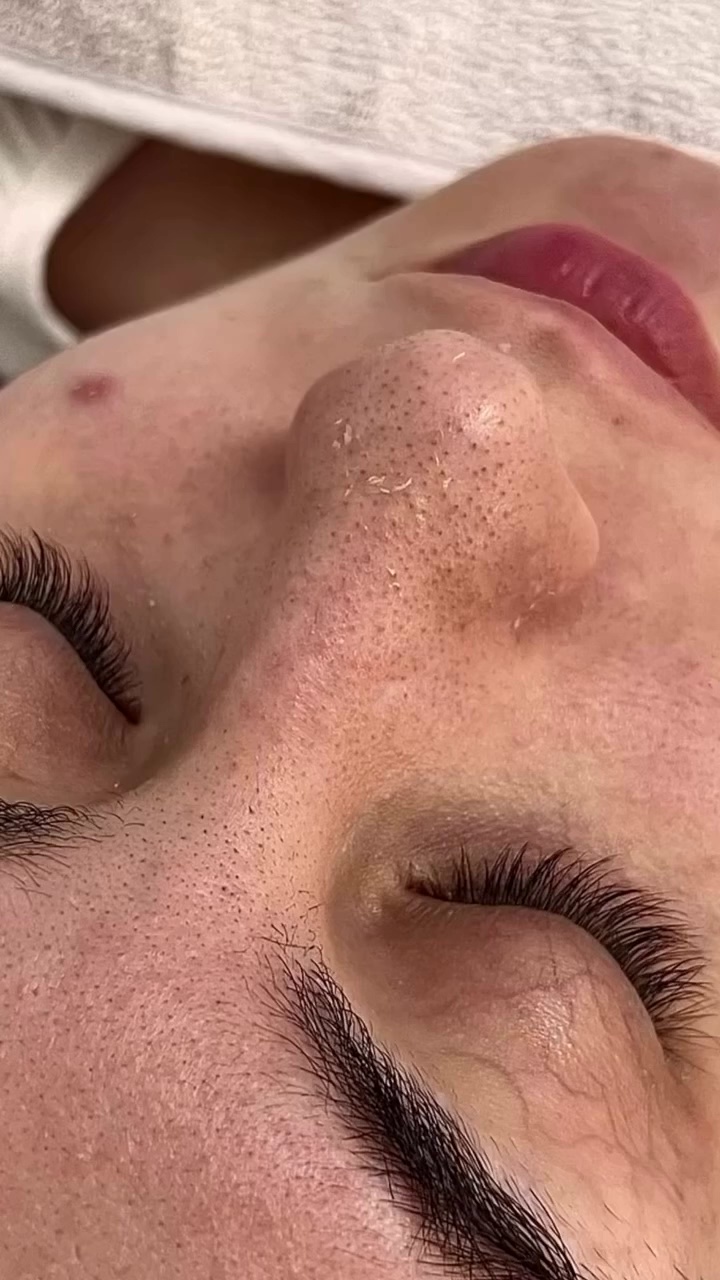 خدمات تخصصی پوست ومولیفت ابرومریم طهرانی