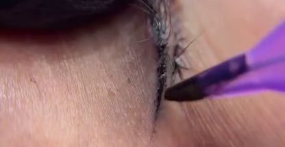 مركز تخصصي ابرو زرکاشت