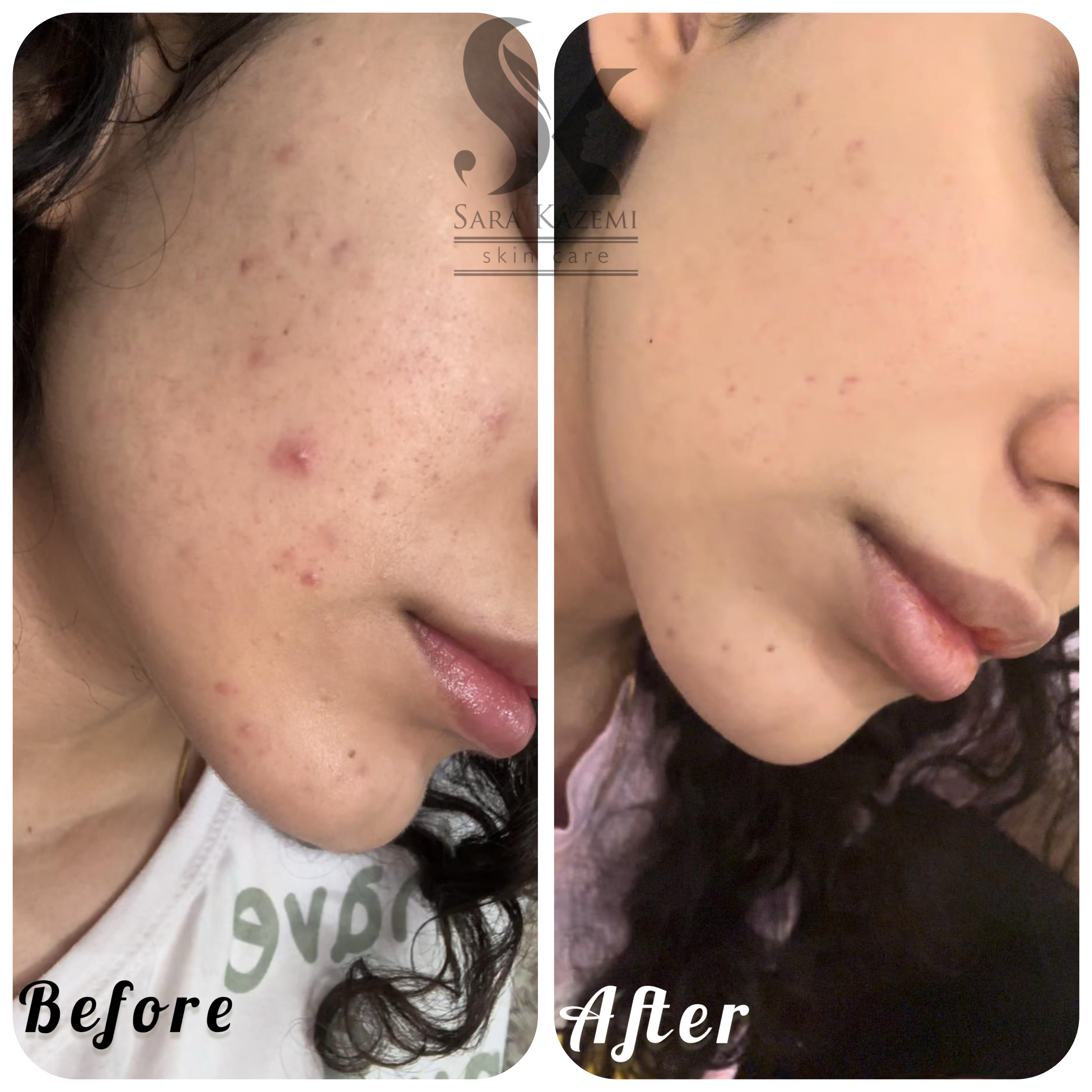 خدمات تخصصی فیشال سارا اسکین بار