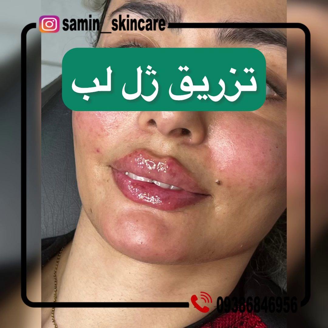 کلینیک پوست مو زیبایی و لیزر ثمین