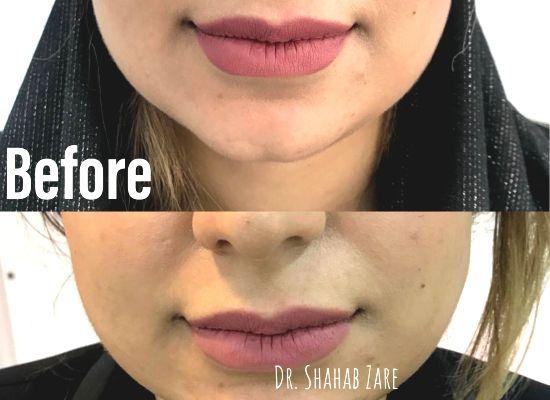 دکتر شهاب زارع