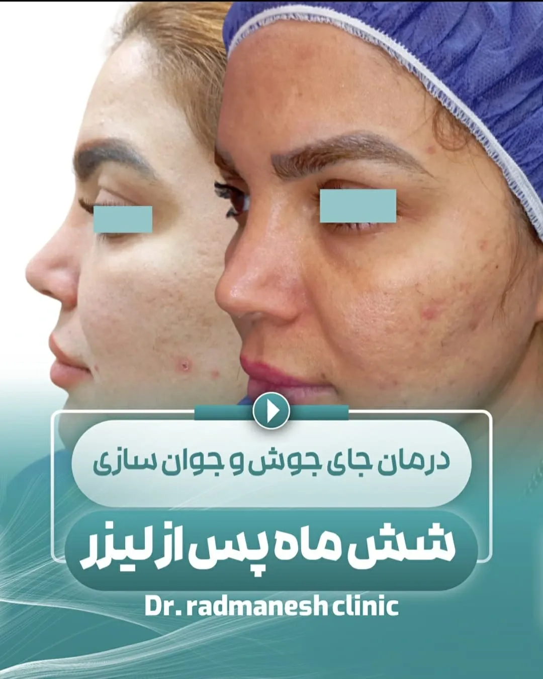 کلینیک زیبایی و لیزر دکتر رادمنش