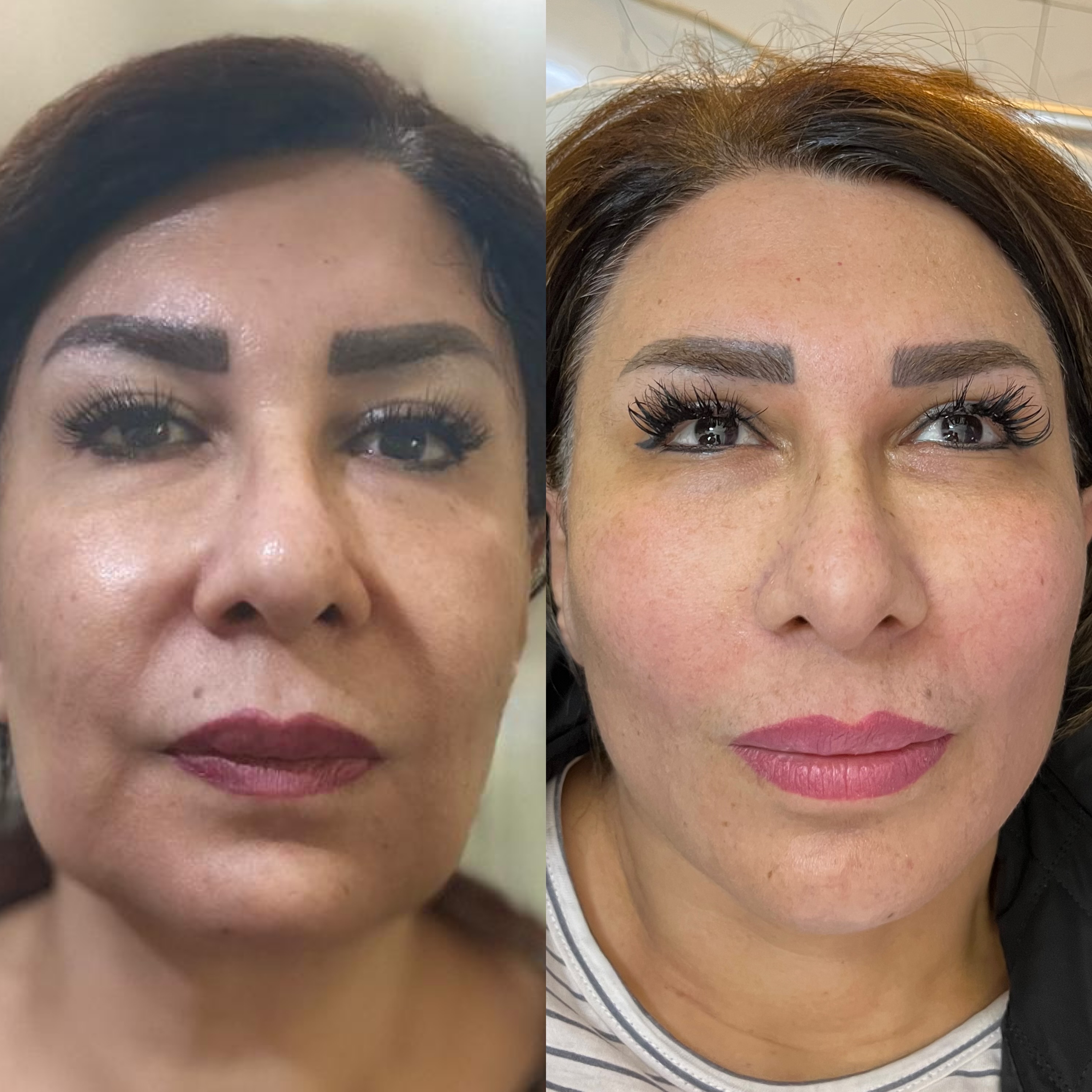 کلینیک اندولیفت پوست و زیبایی دکتر مریمی