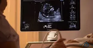 رادیولوژی و سونوگرافی توحید