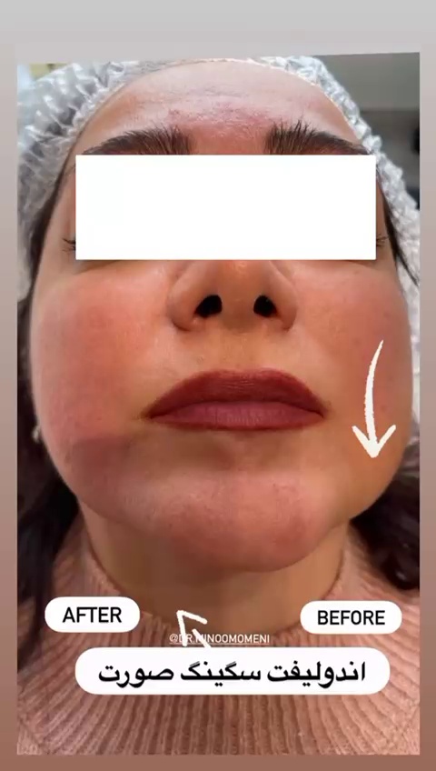 دکتر مینو مومنی