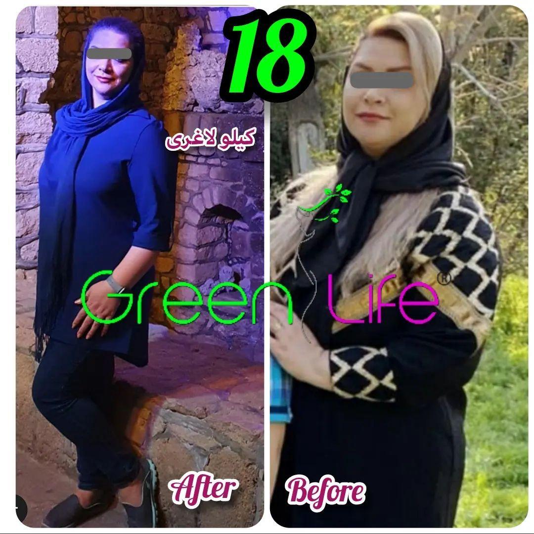 مراکز تخصصی لاغری و زیبایی گرين لايف