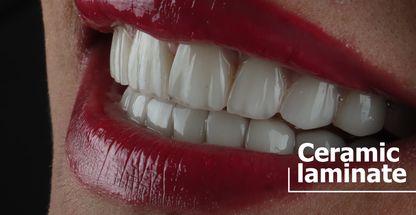 دندانپزشکی دیجیتال دکتر مهدی کثیری