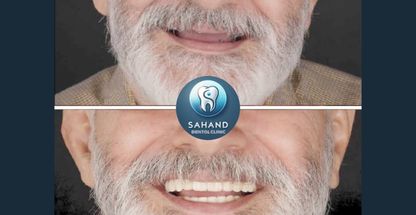 کلینیک دندانپزشکی وایمپلنت سهند(لاجوردی)