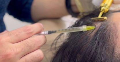 کلینیک لیزر پوست ومو نیک سیما