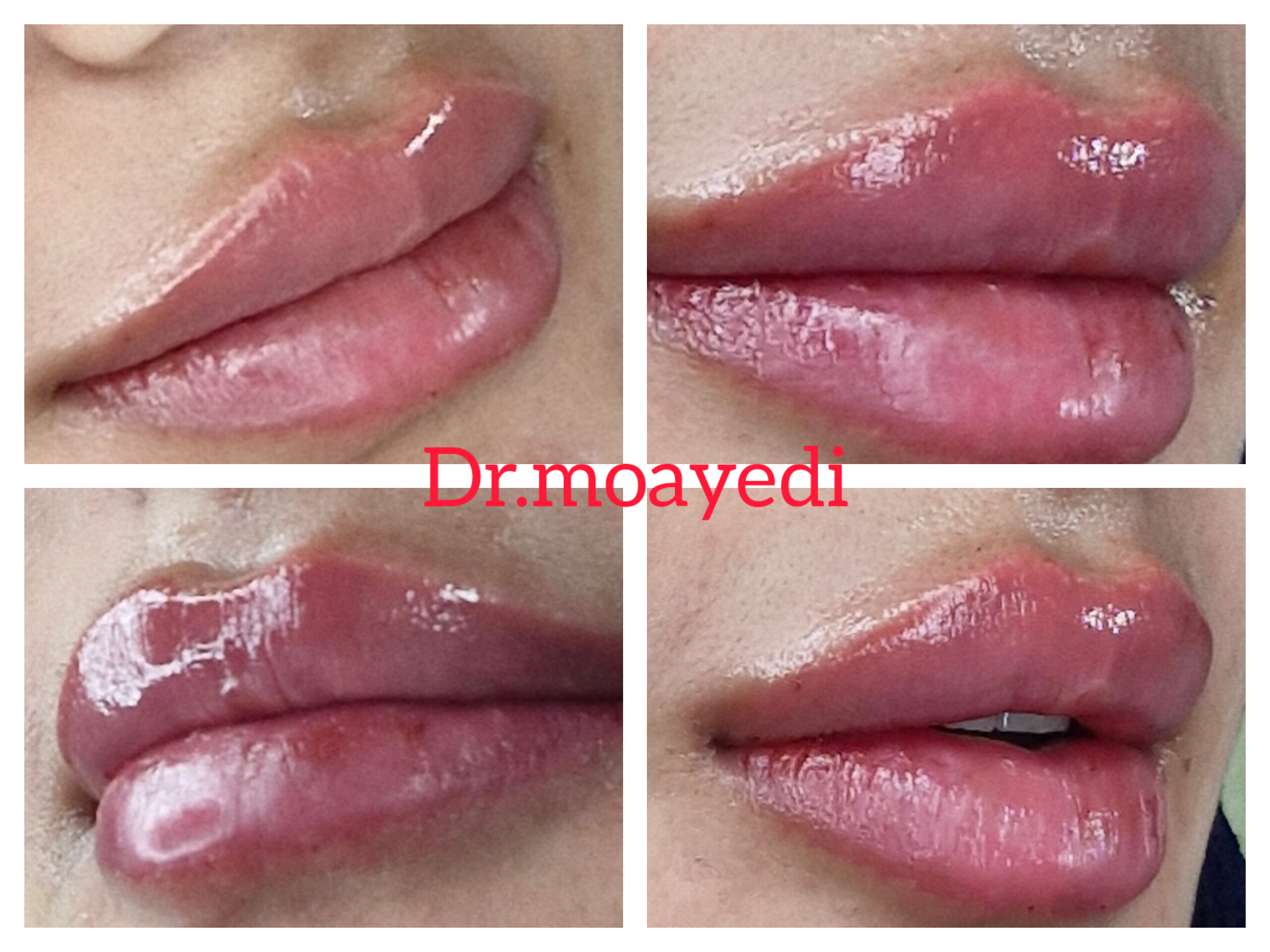 دکتر حمیده مویدی پزشک زیبایی پوست و مو