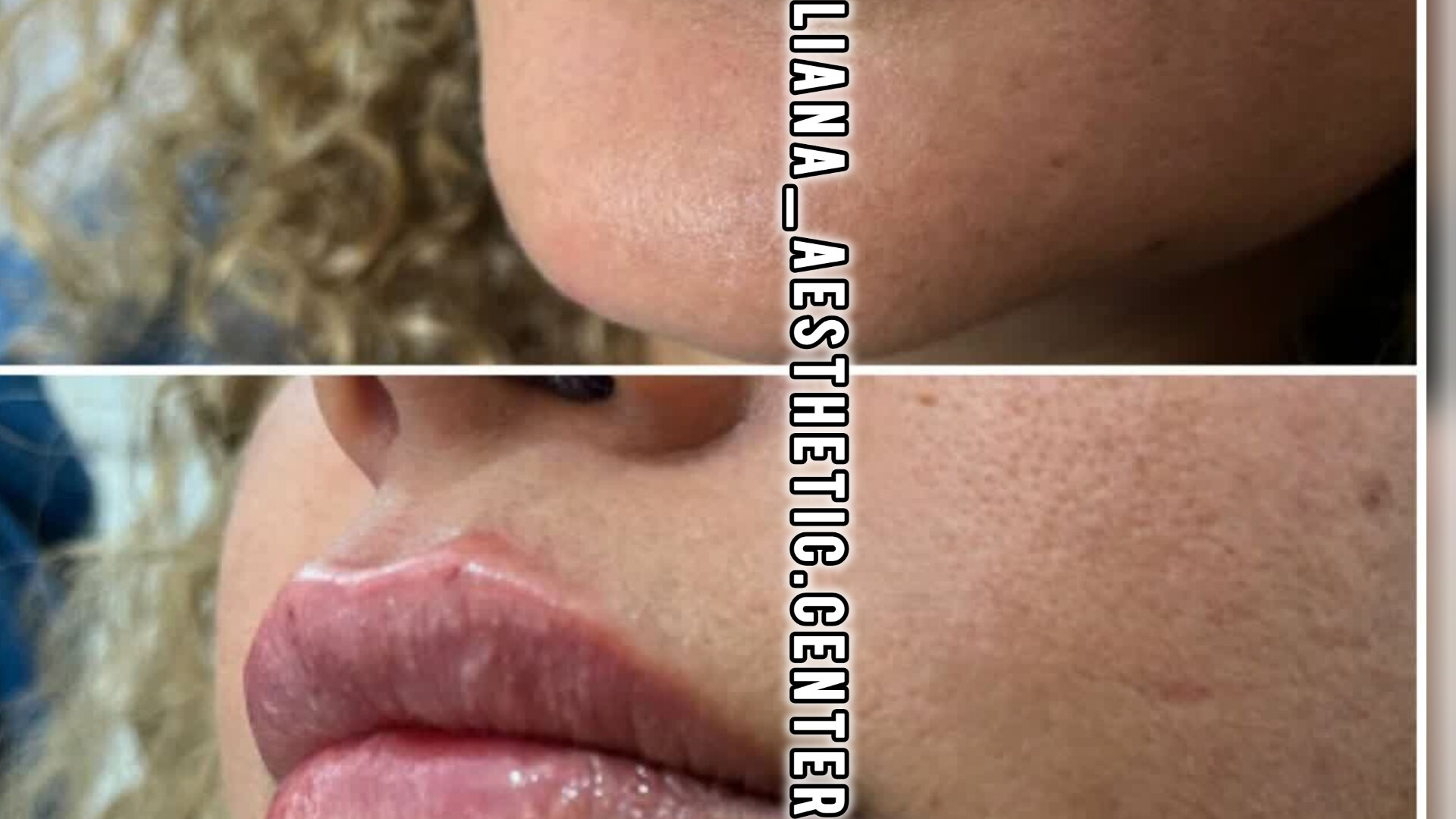 کلینیک پوست،مو،زیبایی لیانا دکترمیرطاوسی