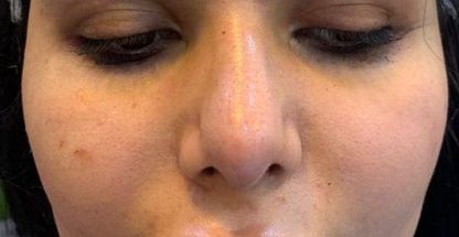 کلینیک کاشت ابرو رویال