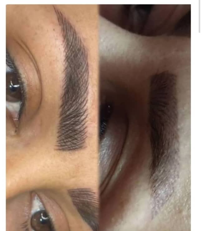 کار میکروبلیدینگ ،شیدینگ لب ،بن مژه