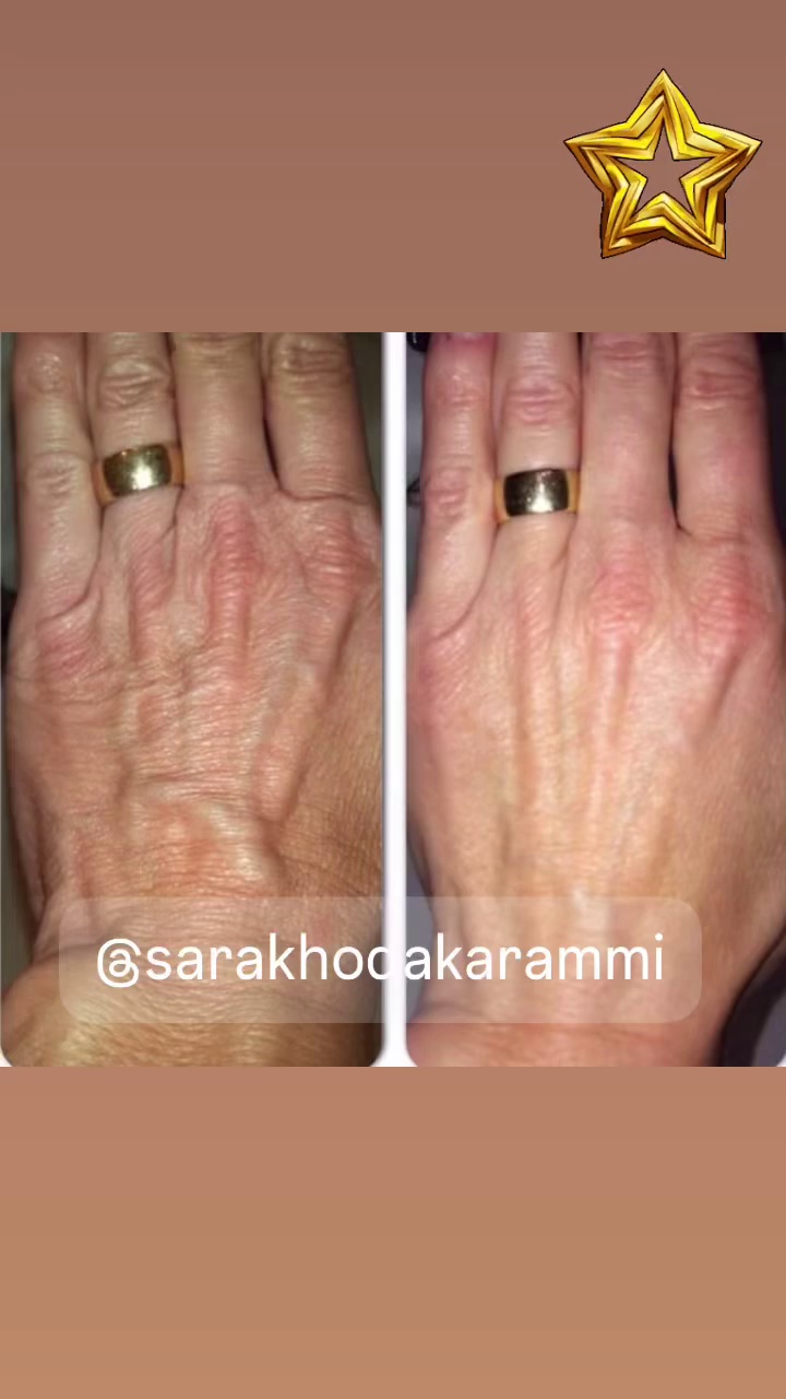 مرکزپوست،زیبایی وتناسب اندام ساراخداکرمی