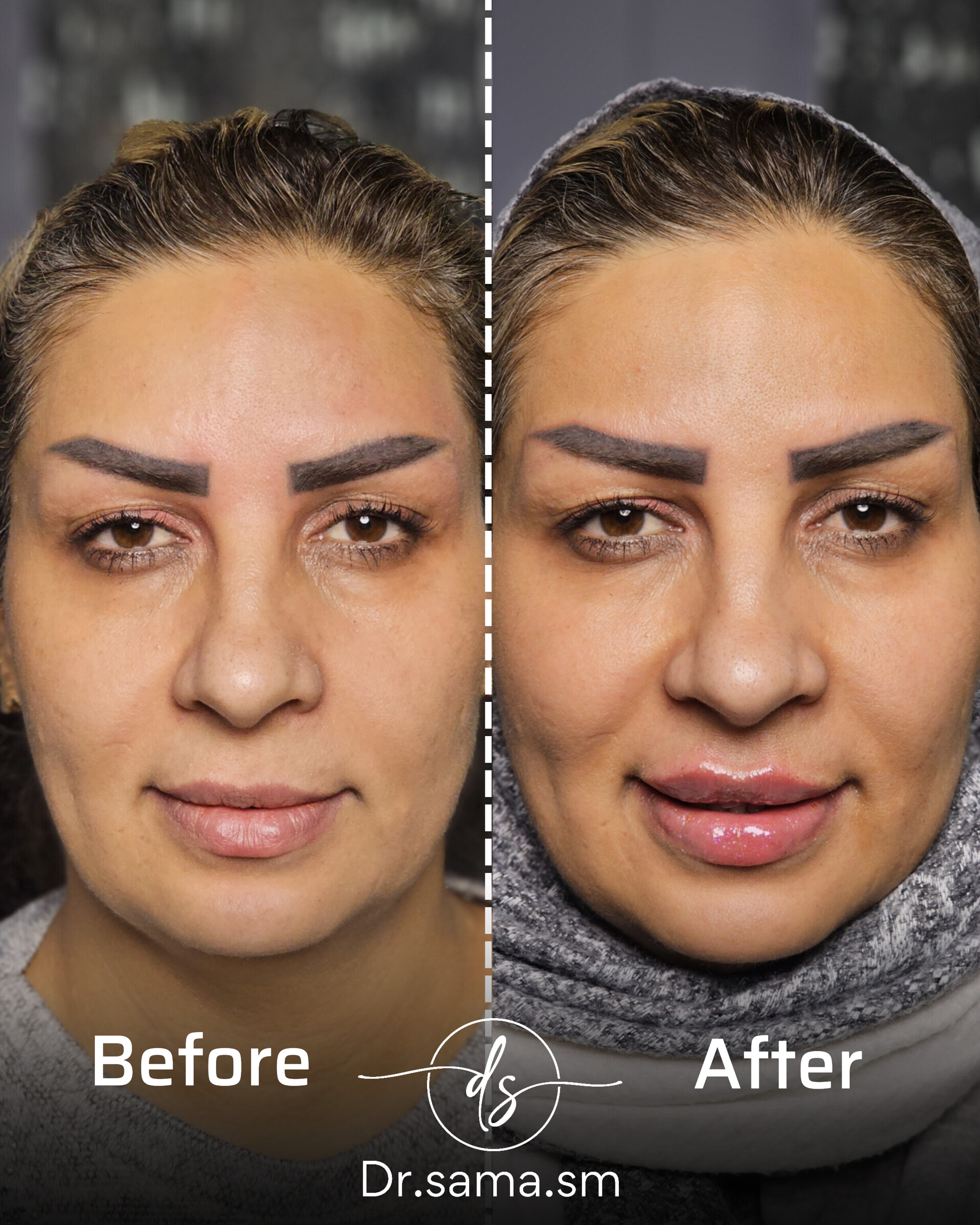 مطب پوست و مو زیبایی دکتر سما