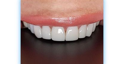 دندانپزشکی خانم دکتر فاطمه رامندی