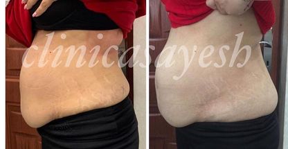 مشاور تغذیه و رژیم درمانی  آسایش