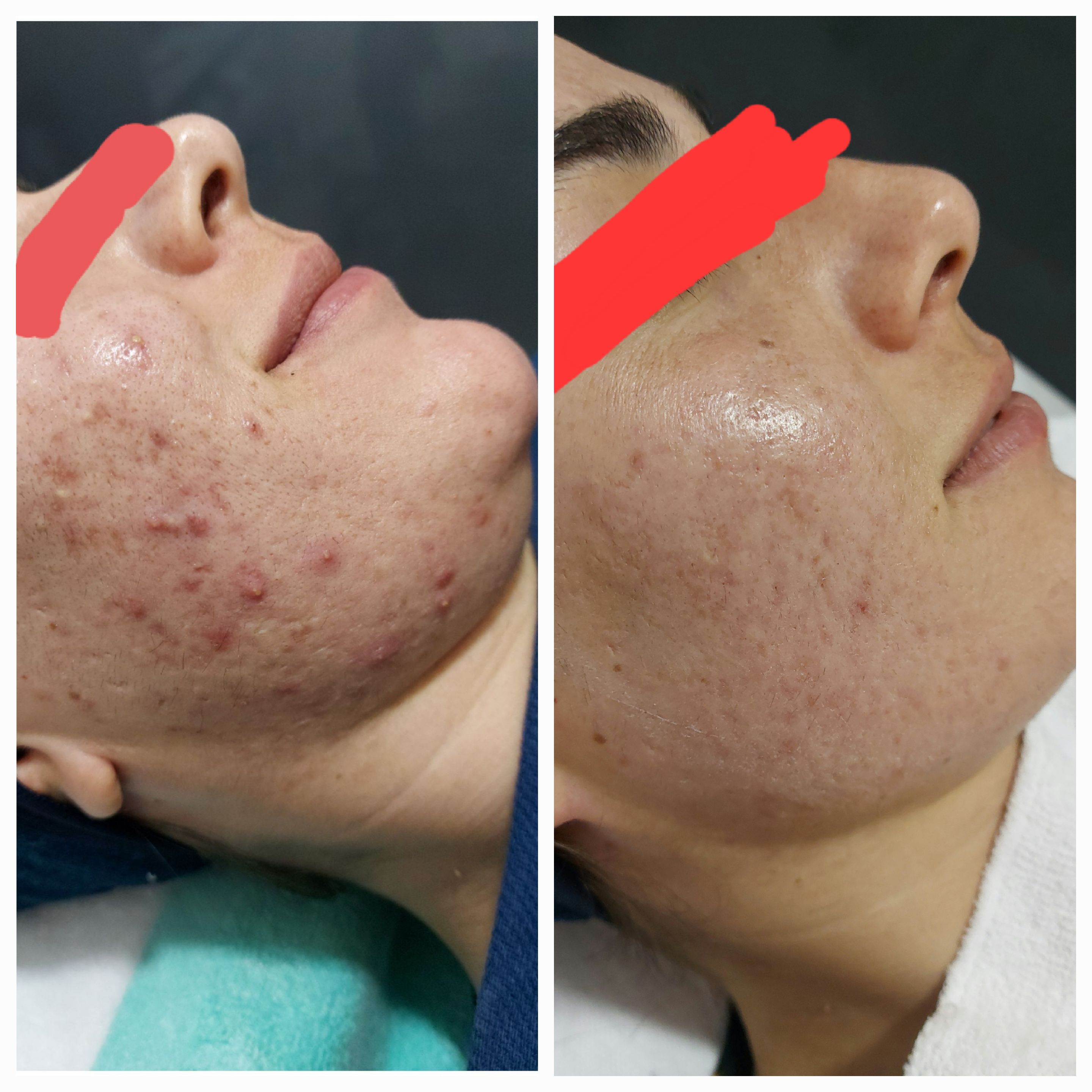 فیشال و پاکسازی شیرین نصیری درمالند