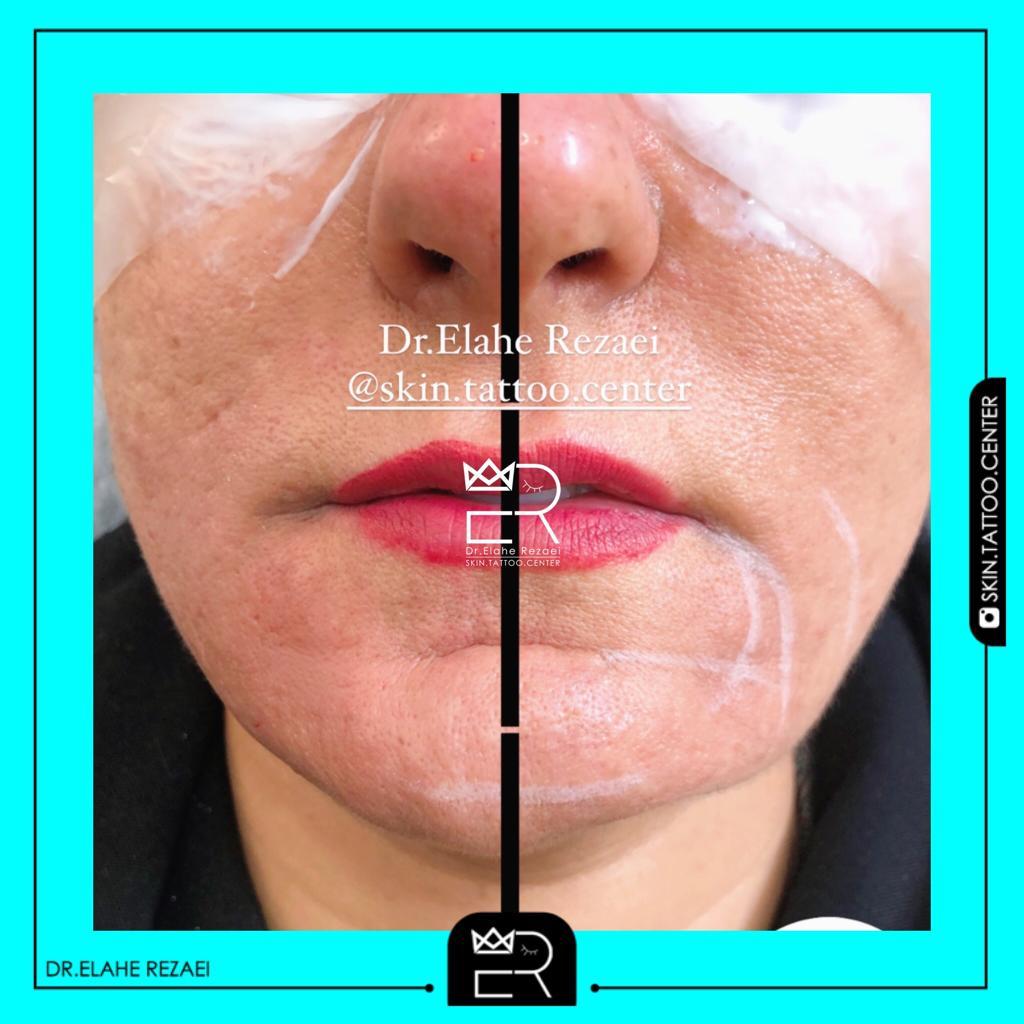 کلینیک تخصصی مدیکال تتو و زیبایی