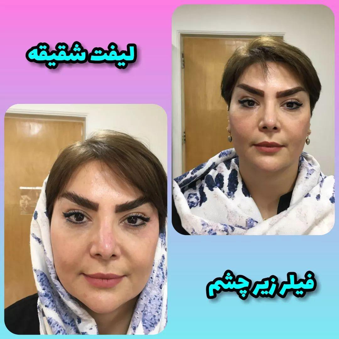 مزکز زیبایی لیا