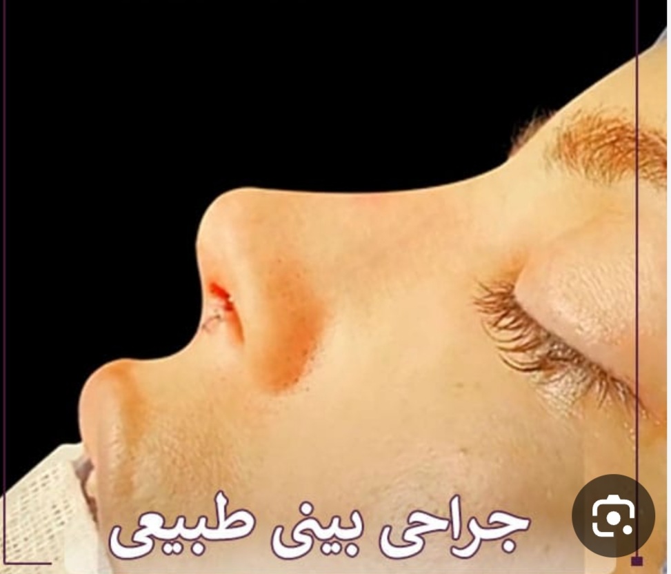 نیکزاد فرشچیان