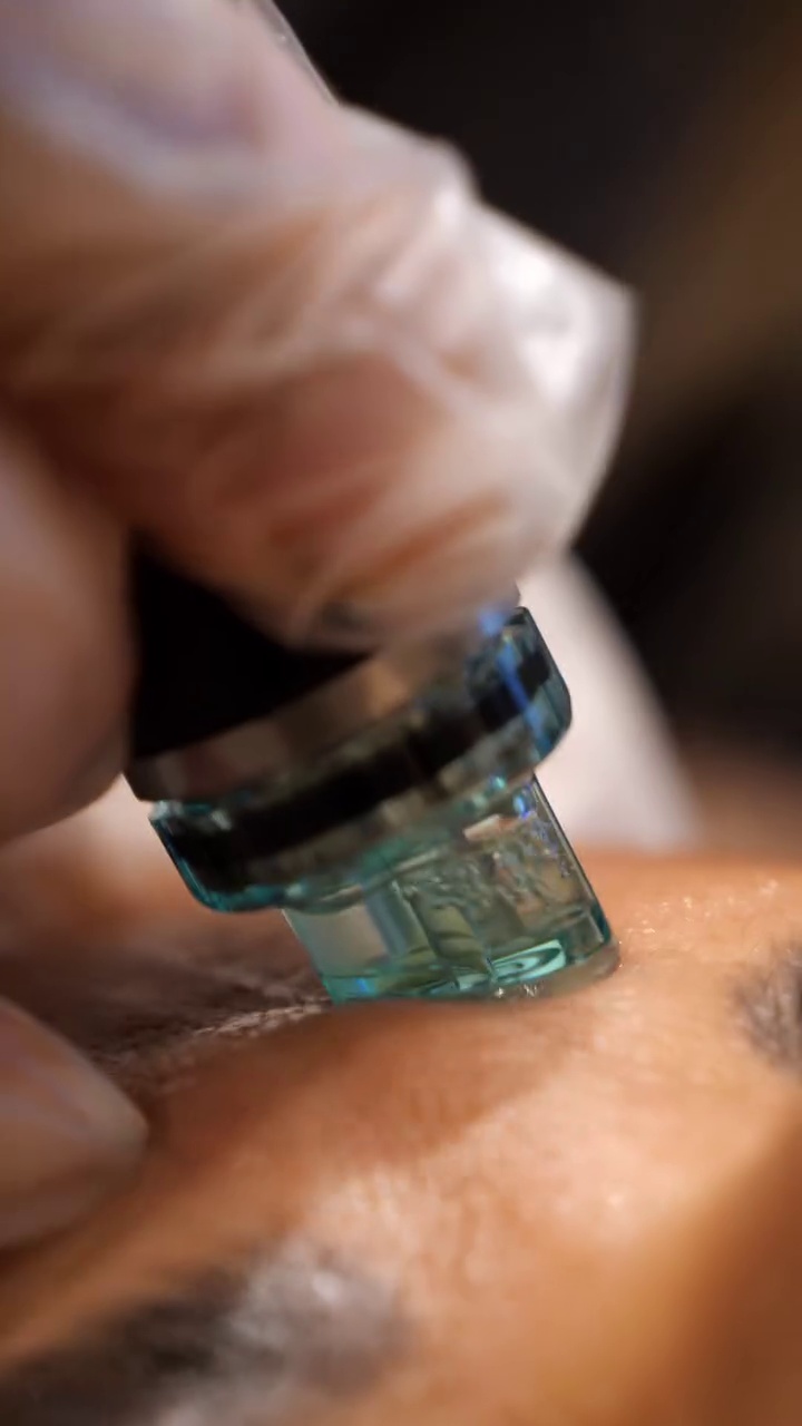 کلینیک زیبایی آزیتا آذر