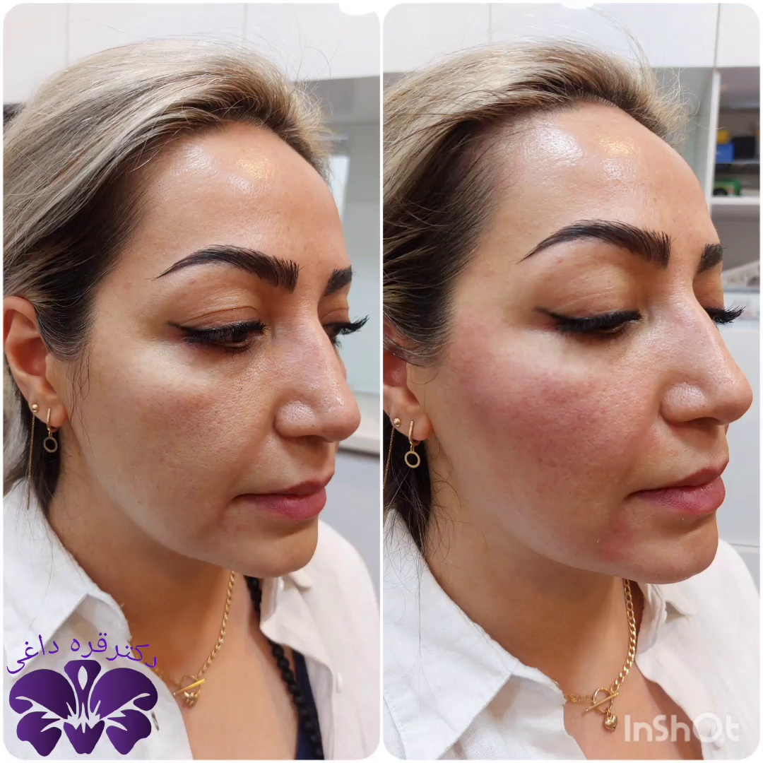 مطب پوست ،مو زیبایی دکتر فاطمه قره داغی