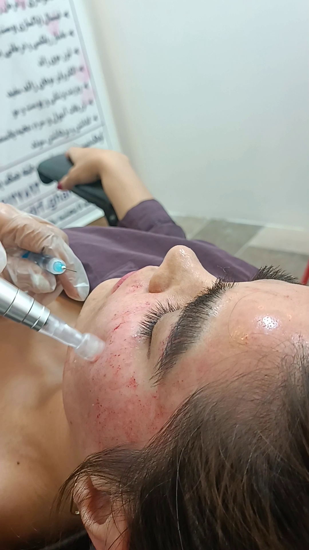 مطب پوست ،مو زیبایی دکتر فاطمه قره داغی