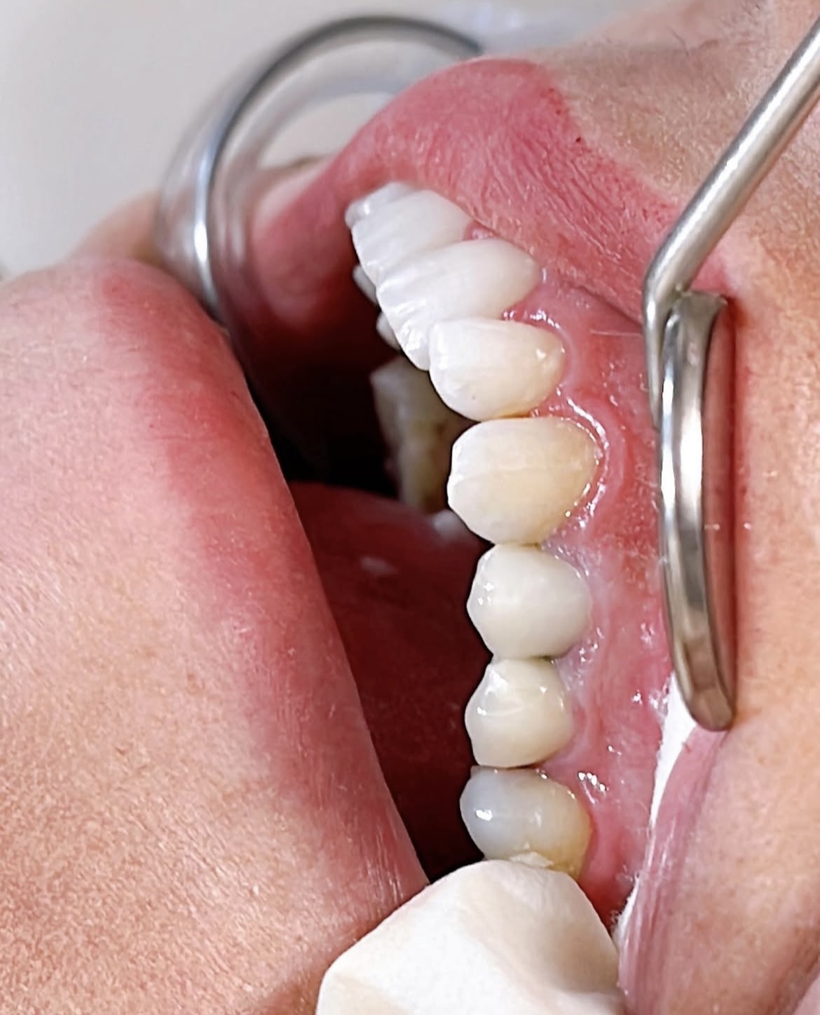 مطب دندانپزشکی دکتر پیمان رستمیان