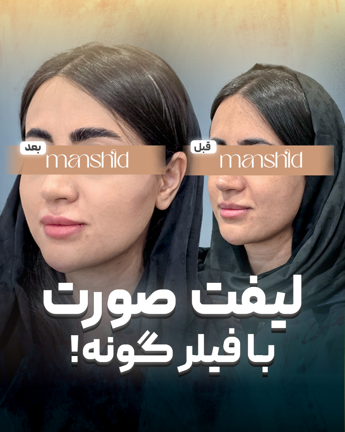 کلینیک زیبایی مانشید