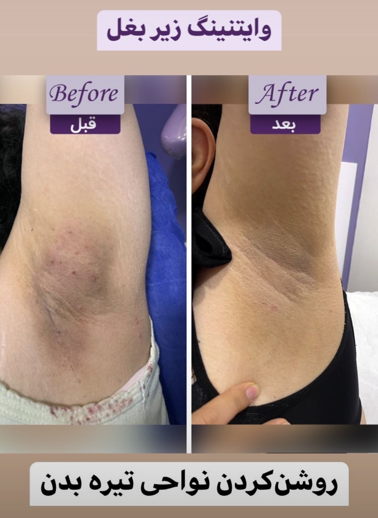 مرکز زیبایی مایلا