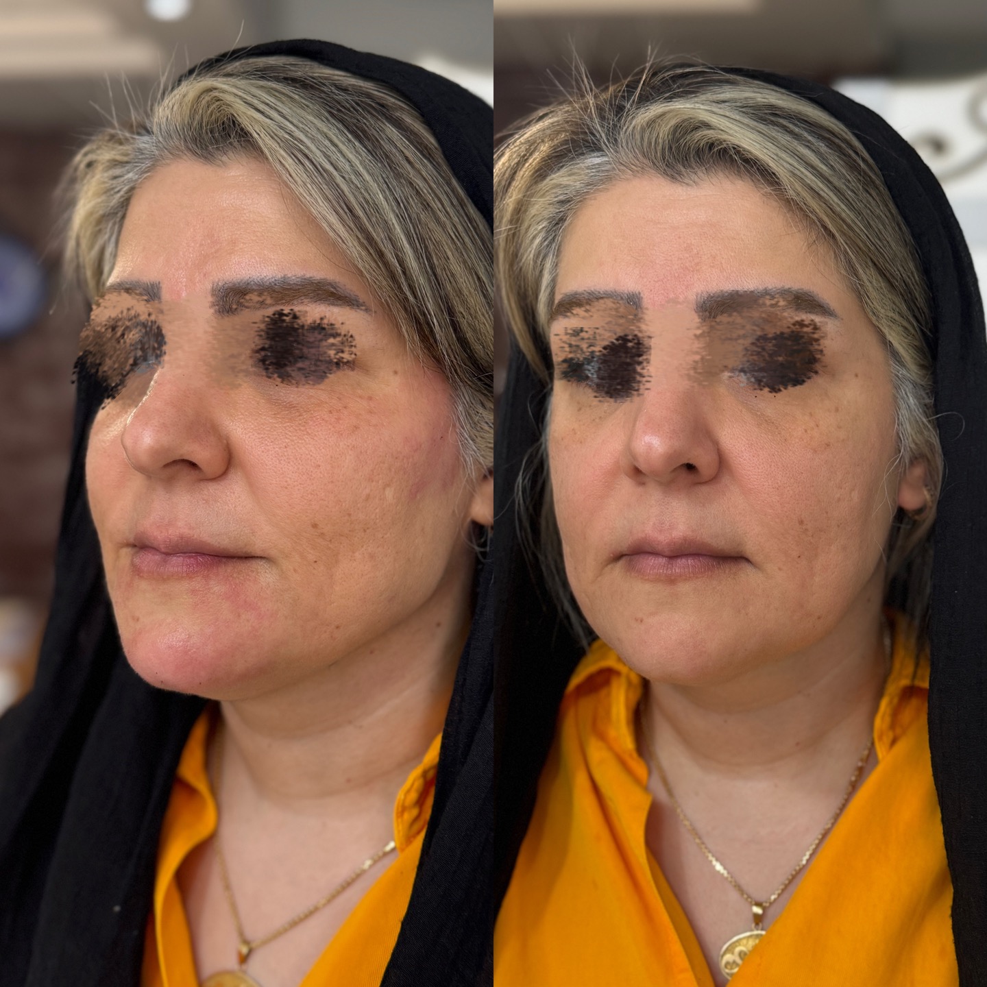 مرکز لیزر، پوست و مو نچرال بیوتی