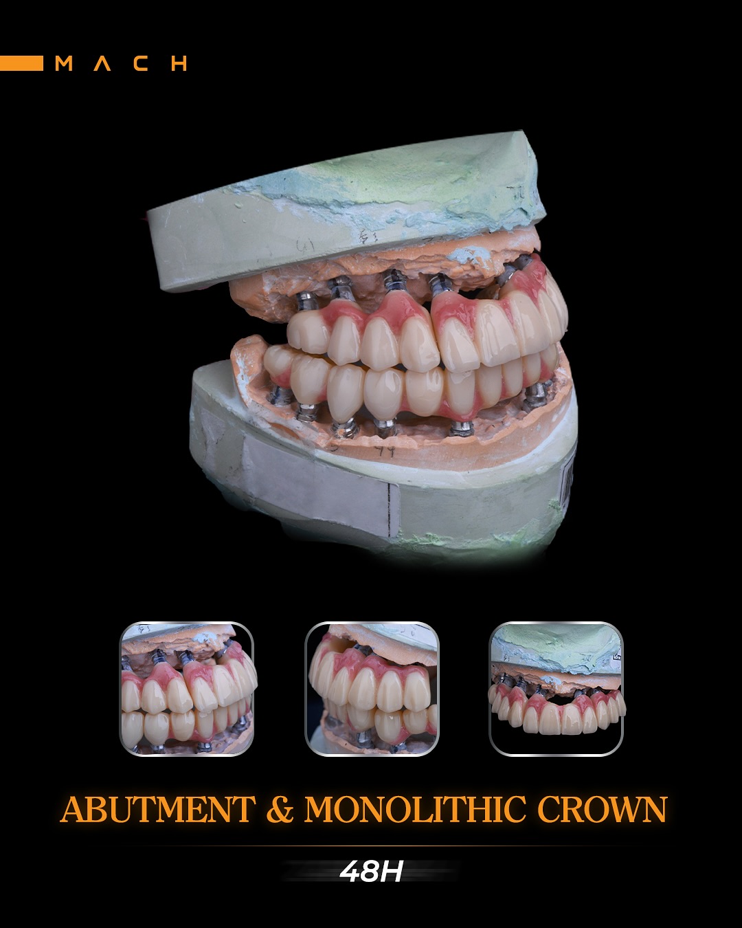 لابراتوار دندانسازی دیجیتال ماخ