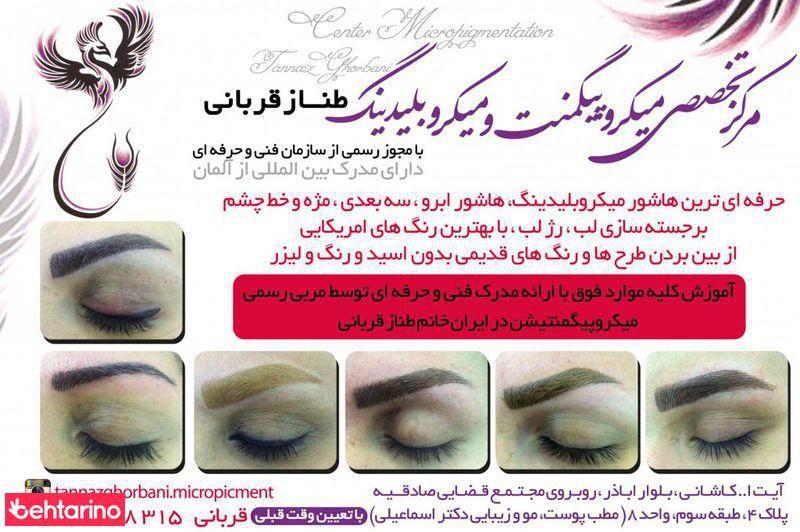 میکروپیگمنتشین قربانی