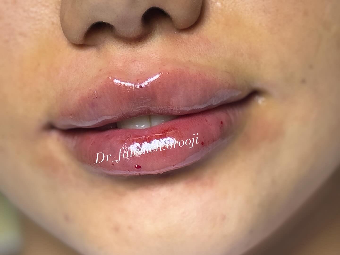 کلینیک زیبایی دکتر فاطمه عروجی