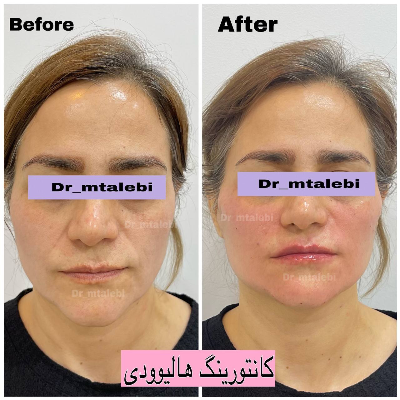 مرکز پوست،مو و زیبایی دکتر مهشید طالبی