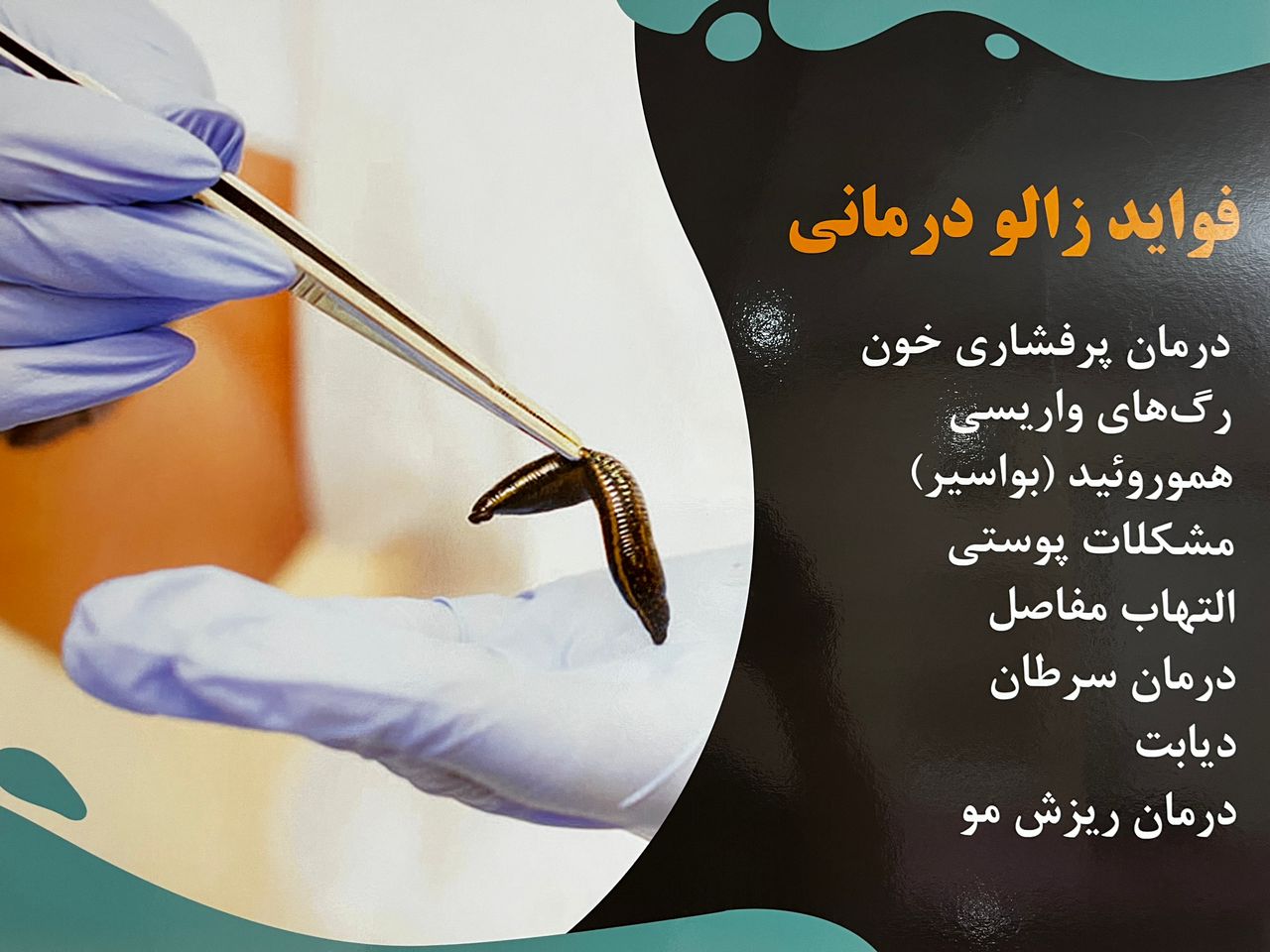 حجامت شعبانی زیر نظر پزشک