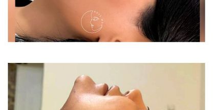 کلینیک زیبایی و مرکز لیزر روی ماه