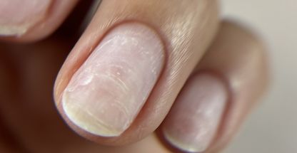 کاشت ناخن مرکز تخصصی بیتا آبروش