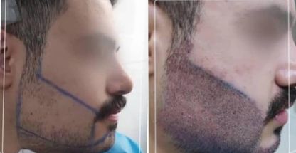 کلینیک زیبایی و کاشت دکتر وارث