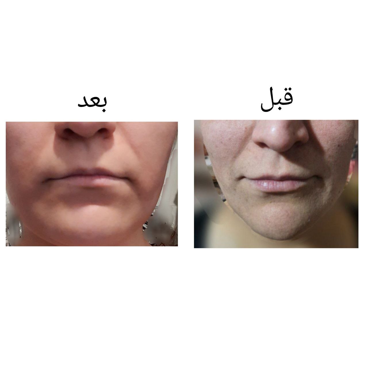 مراقبت زیبایی عادلی