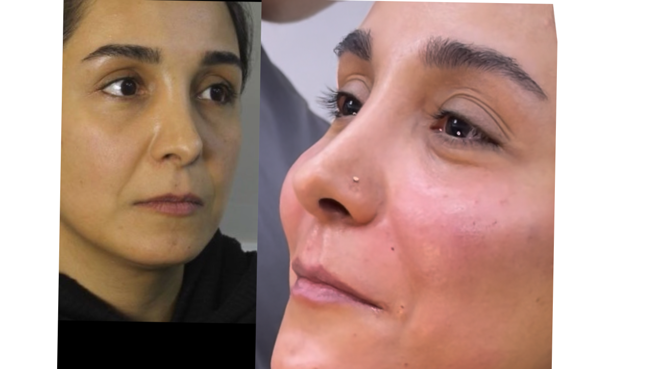 کیلینیک پوست مو زیبایی نیل