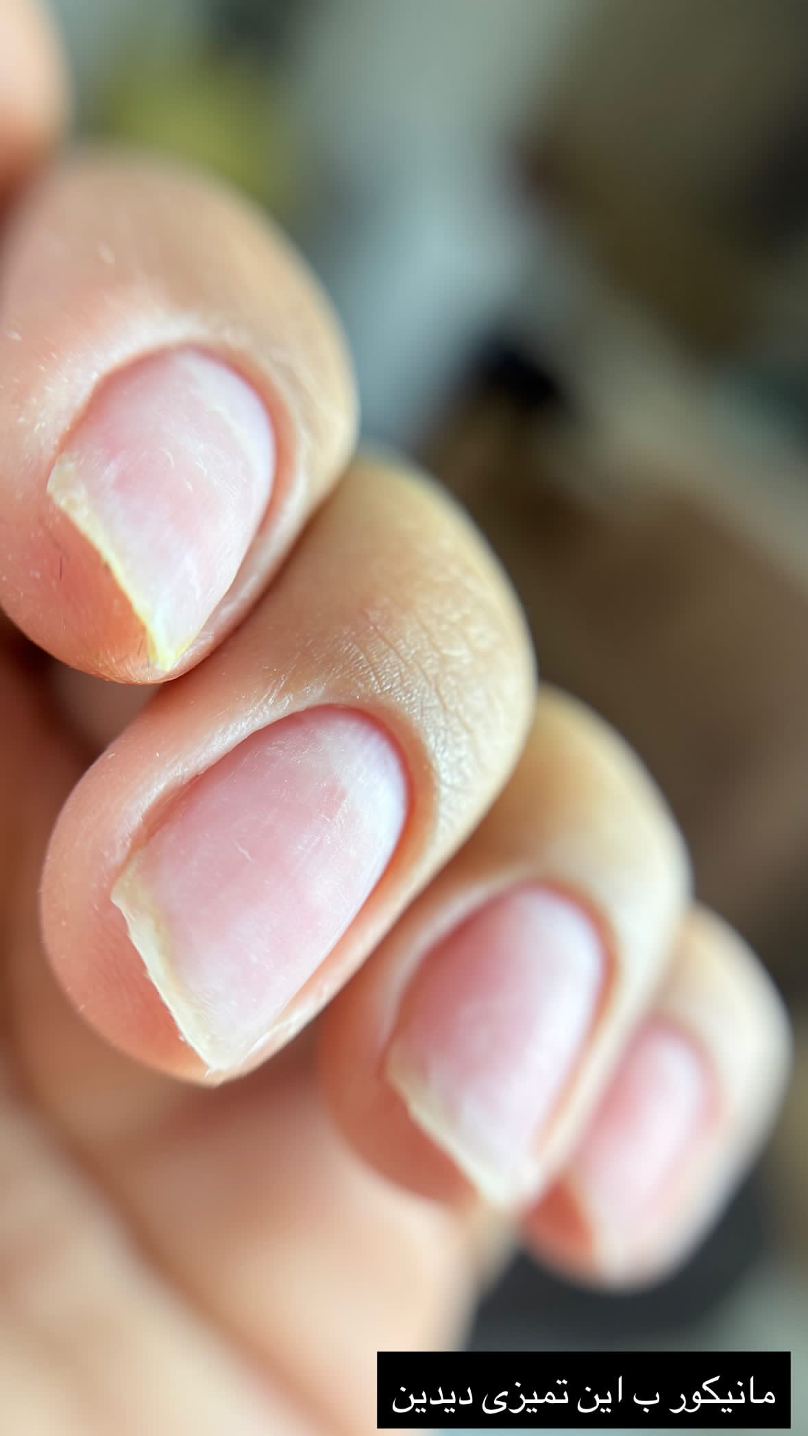 خدمات ناخن کاشت،ترمیم،لمینت شادی رسولپور