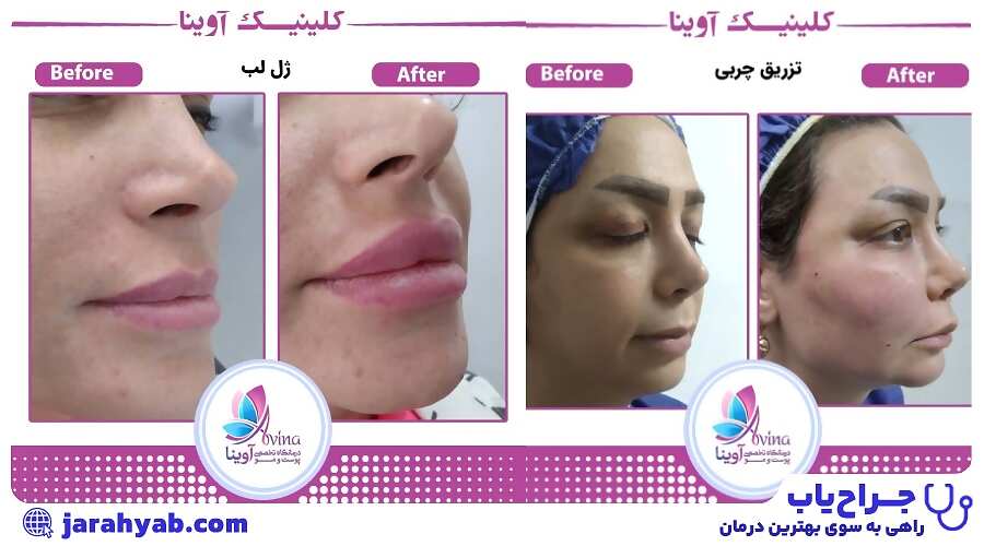 کلینیک پوست و مو آوینا کرج