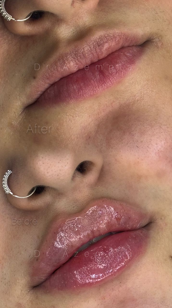 کلینیک پوست مو و لیزر اِلورین