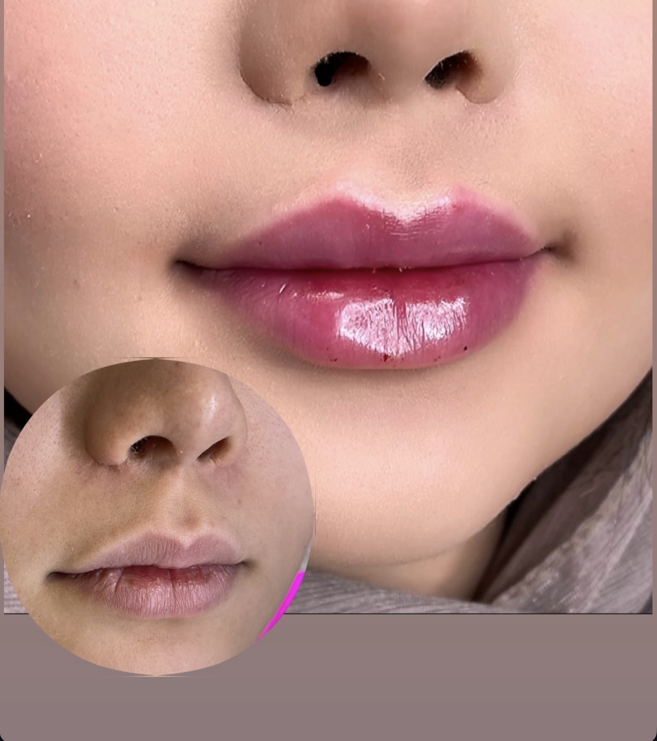 مرکز لیزر ،پوست و زیبایی کندی بیوتی