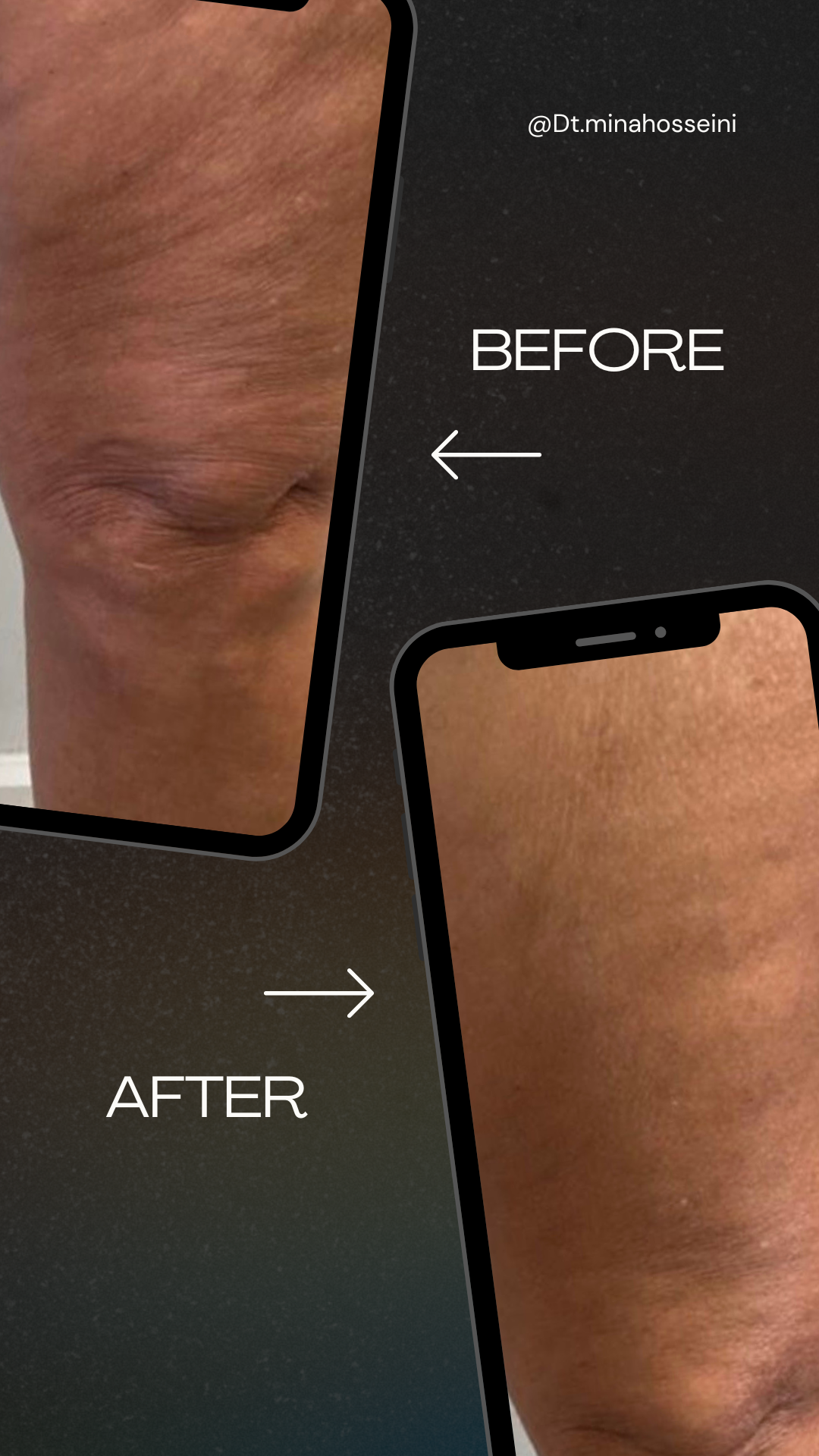 مرکز تخصصی تغذیه و رژیم لاغری آنوفیت