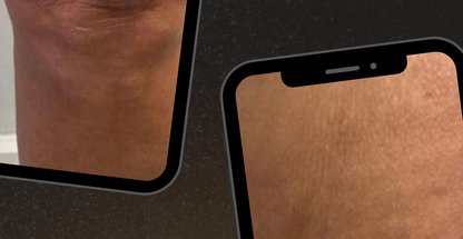 مرکز تخصصی تغذیه و رژیم لاغری آنوفیت