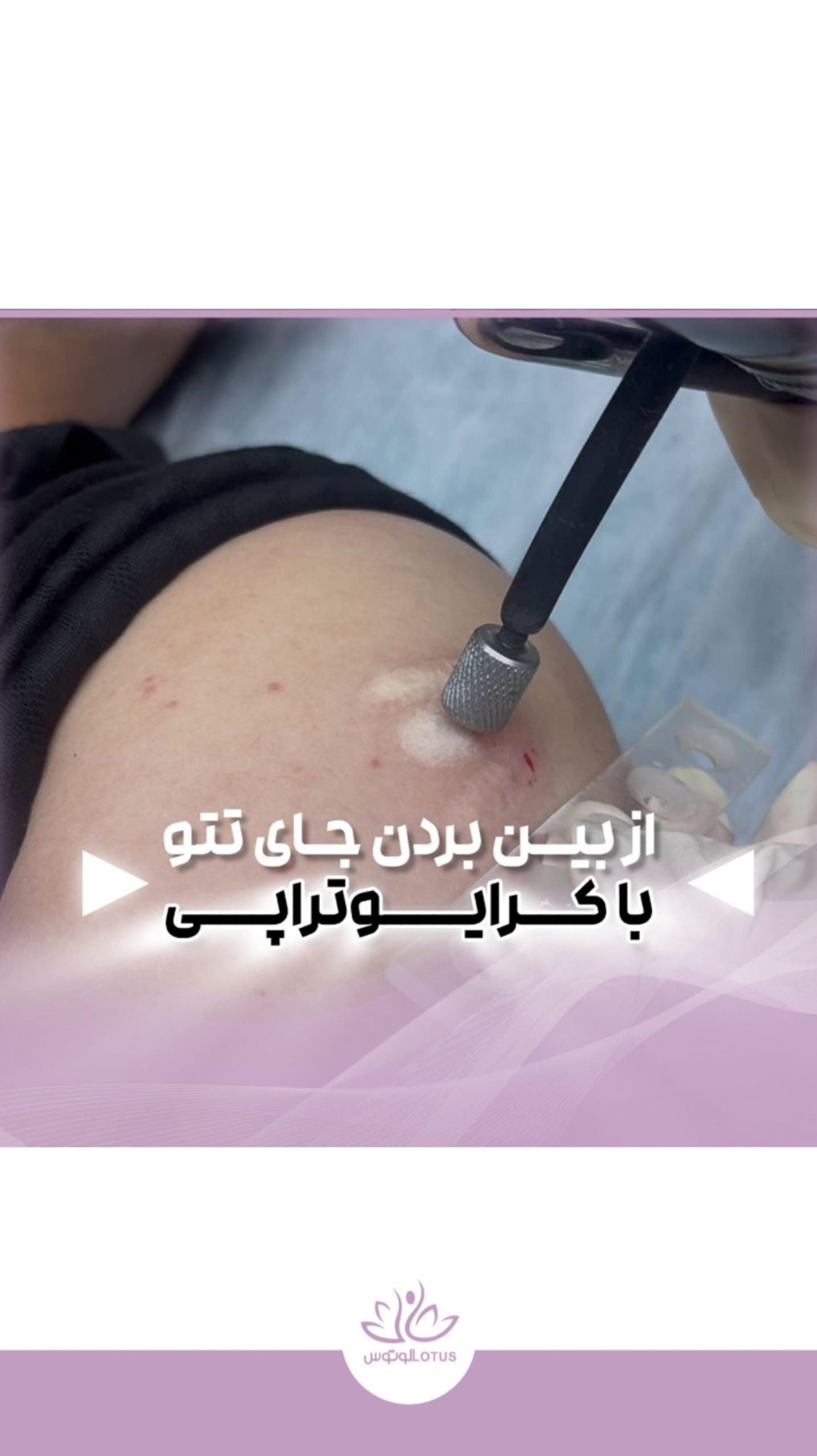 کلینیک زیبایی و لاغری و لیزر لوتوس